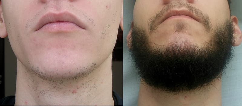 Чоловіча борода - безумовний тренд сучасності