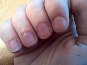 Основа красивого манікюру - це не тільки ідеальна форма нігтів і оригінальний нейл - арт, але і доглянута і здорова шкіра рук
